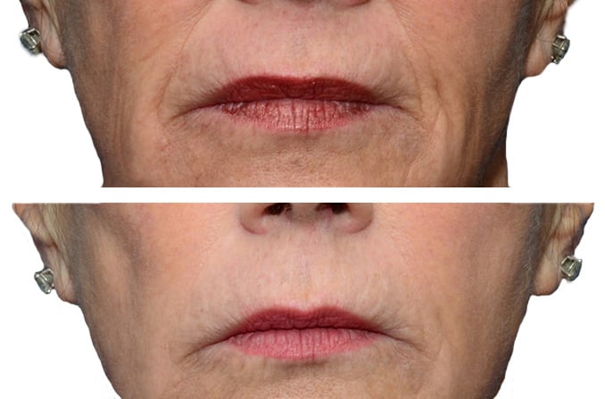 lips